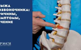 Как узнать есть ли у Вас симптомы грыжи межпозвоночного диска?